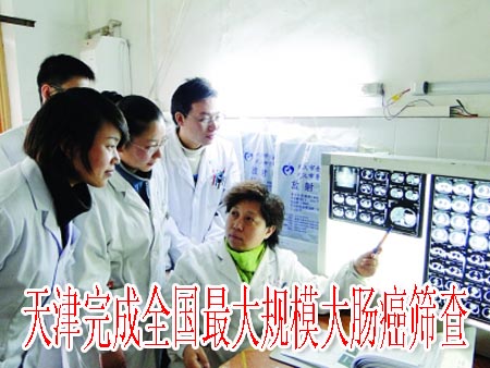 天津完成全国最大规模大肠癌筛查