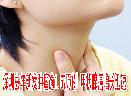 深圳去年新发肿瘤逾1.67万例 甲状腺癌增长迅速