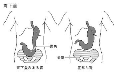 偏方-胃下垂