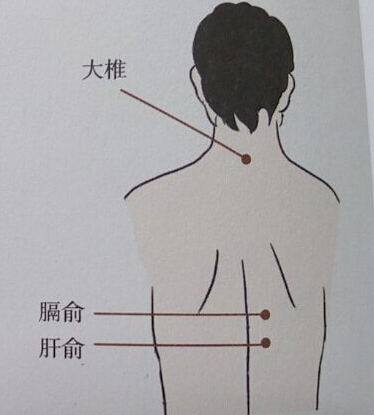 贫血的特色中医针灸疗法介绍